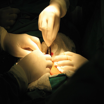 Chirurgia ortopedica mini invasiva - Sempreinpiedi